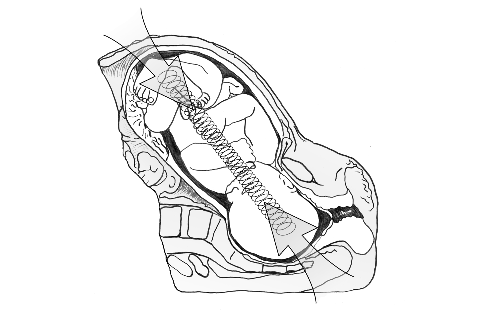 Axial birthing forces